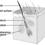 Homeopathic management of Pimples ( Acne)