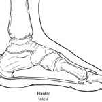 HEEL PAIN